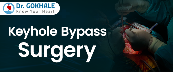 Minimally invasive keyhole bypass heart surgery by Dr Gopala Krishna Gokhale